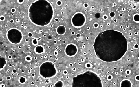 白肺的原因是细菌感染吗？为什么