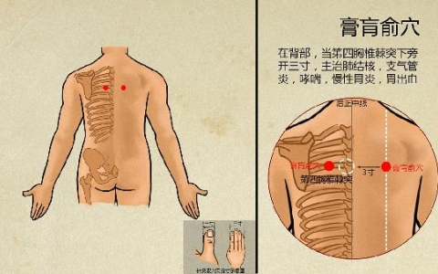 梨状肌综合征的最佳治疗方法穴位