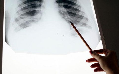 肿瘤坏死因子抑制剂伤口愈合