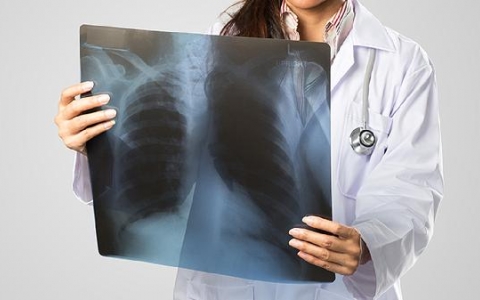 肺癌的中医辨证论治及分型治疗